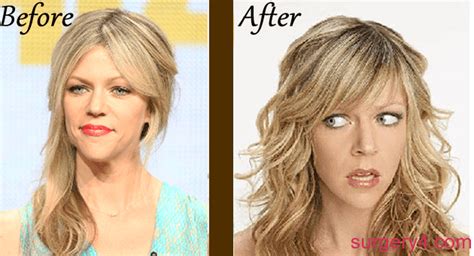 kaitlin olson mr skin|Kaitlin Olsons Plastic Surgery